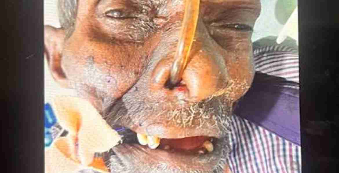കോഴിക്കോട് മെഡിക്കൽ കോളേജ് 